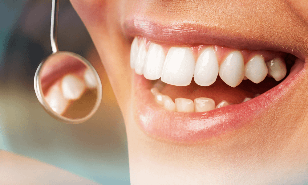 O que é periodontia e qual a sua importância? Descubra aqui.