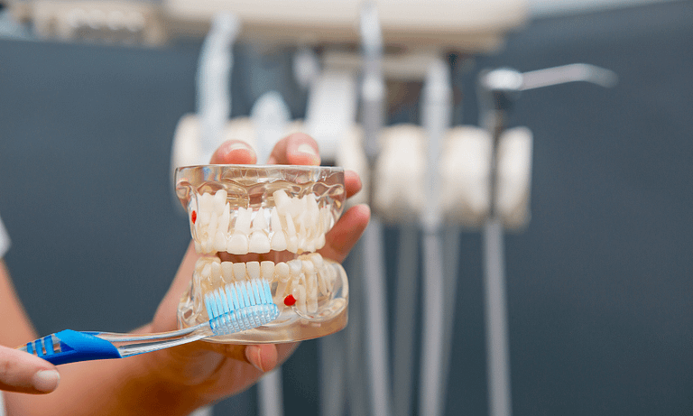 5 dicas para conservar o seu implante dental