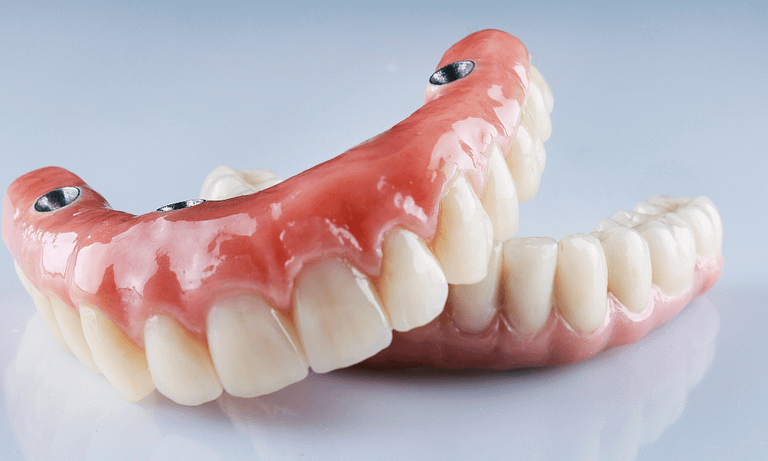 O que é prótese dental? Saiba agora