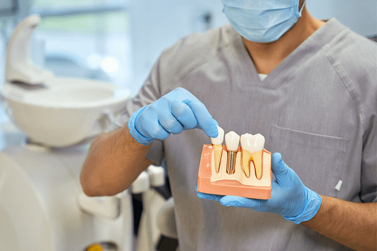 Implante dentário: qual o melhor e principais características
