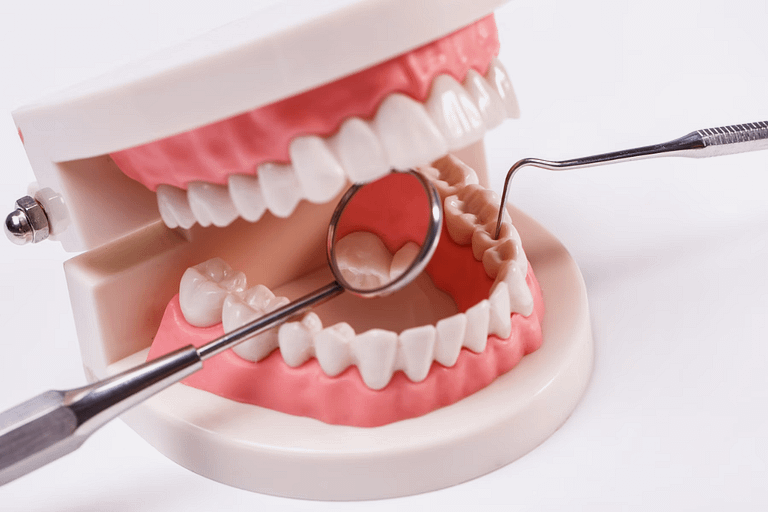 Quem tem perda óssea pode usar dentadura? Te contamos aqui, descubra